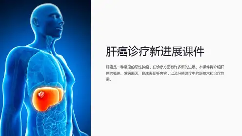 《肝癌诊疗新进展课件》