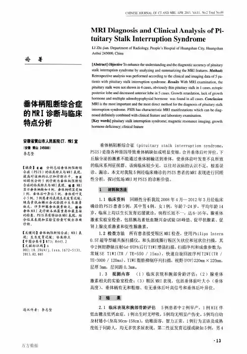 垂体柄阻断综合症的MRI诊断与临床特点分析