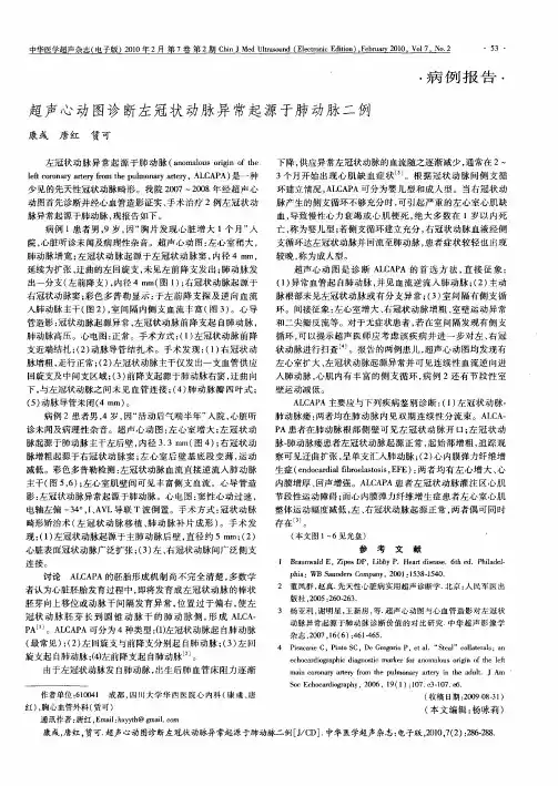 超声心动图诊断左冠状动脉异常起源于肺动脉二例