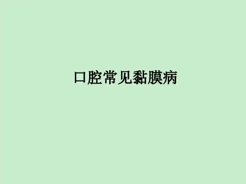 口腔常见黏膜病修改版