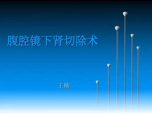 腹腔镜下肾切除术