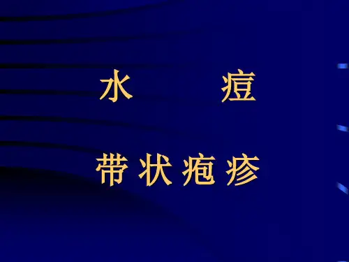 传染病课件：水痘带状疱疹