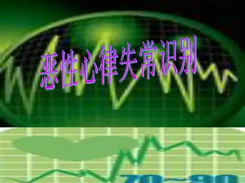 恶性心律失常识别课件