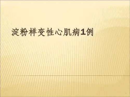 淀粉样变性心肌病一例