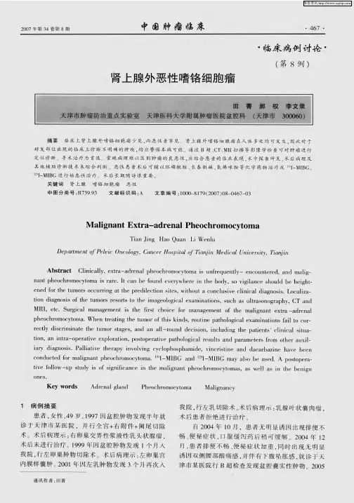 肾上腺外恶性嗜铬细胞瘤