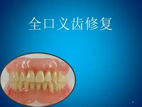 全口义齿ppt课件