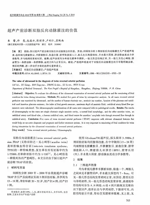超声产前诊断双胎反向动脉灌注的价值
