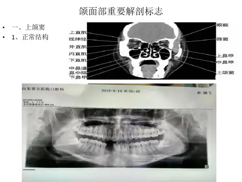 颌面部重要解剖标志