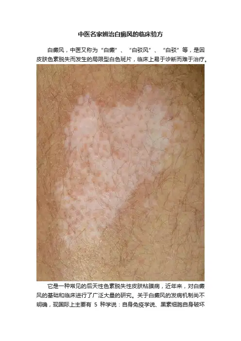 中医名家辨治白癜风的临床验方