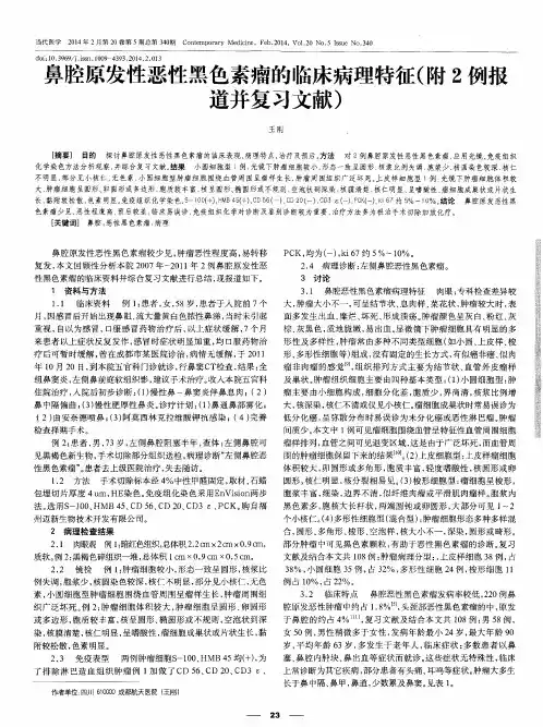 鼻腔原发性恶性黑色素瘤的临床病理特征(附2例报道并复习文献)