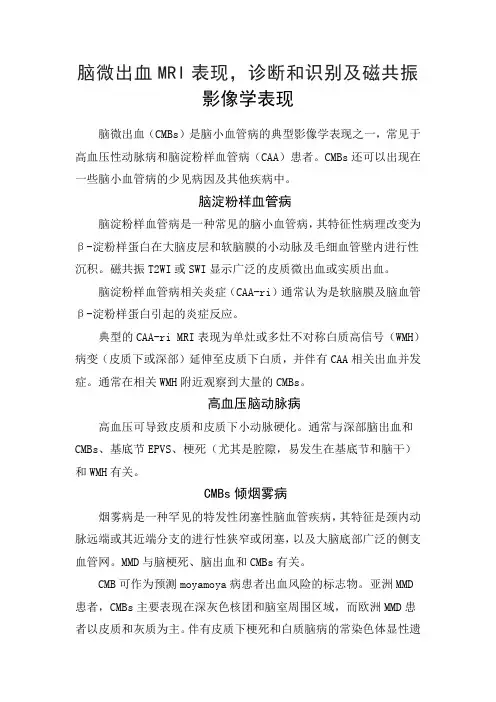脑微出血MRI表现,诊断识别及磁共振影像学表现