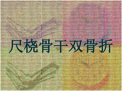 尺桡骨干双骨折 (3)