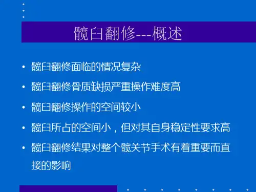 髋臼翻修.ppt