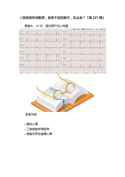 三度房室传导阻滞，房室干扰性脱节，怎么看？「第227期」