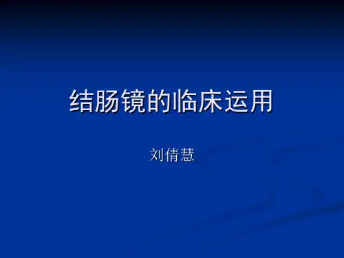 肠镜的检查配合