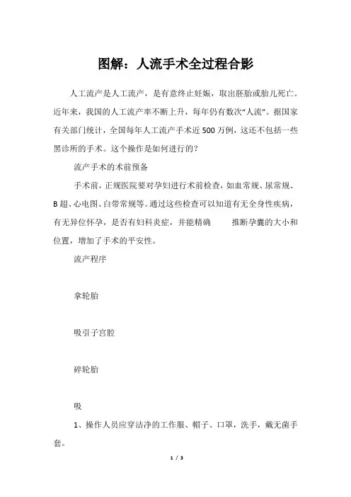 图解：人流手术全过程合影