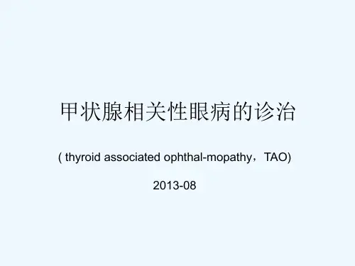 甲状腺相关性眼病诊治