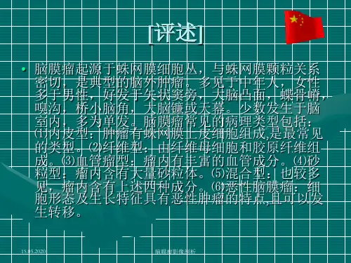 脑膜瘤CT、MRI表现34页PPT