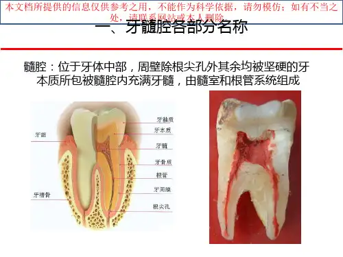 下颌磨牙髓腔解剖和开髓培训课件