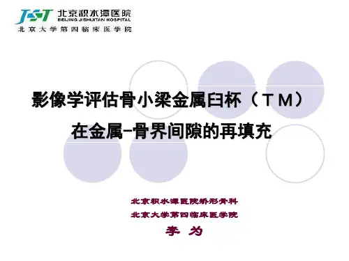 《北京积水潭医院矫形骨科 北京大学第四临床医学院 李为》