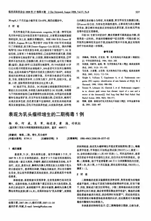 表现为乳头瘤样增生的二期梅毒1例