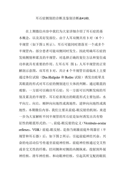 耳石症侧别的诊断及鉴别诊断