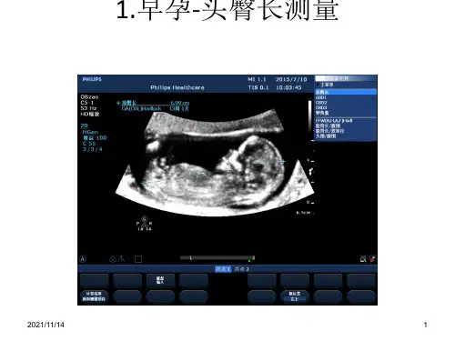 早中孕胎儿筛查标准切面