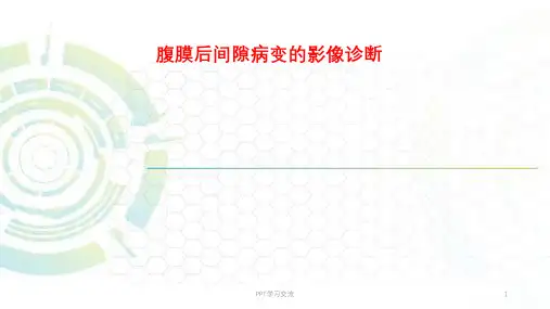 腹膜后间隙病变的影像诊断ppt课件
