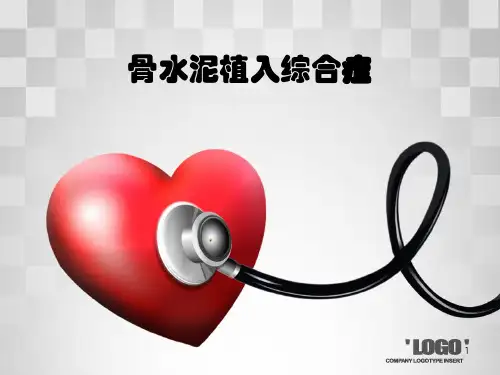 骨水泥ppt课件