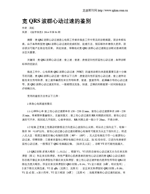 宽QRS波群心动过速的鉴别