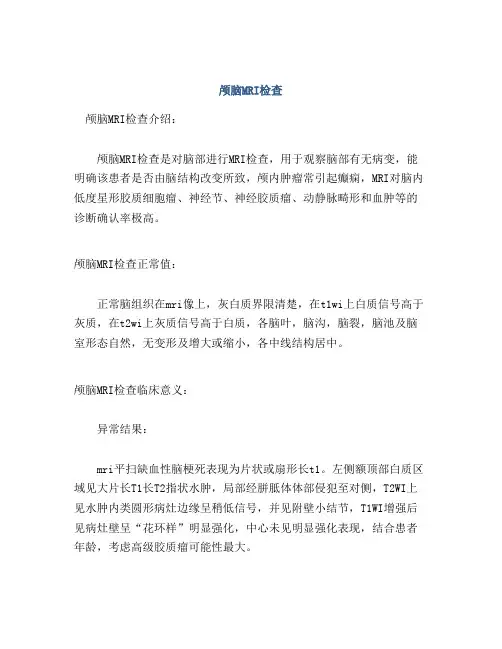 颅脑MRI检查