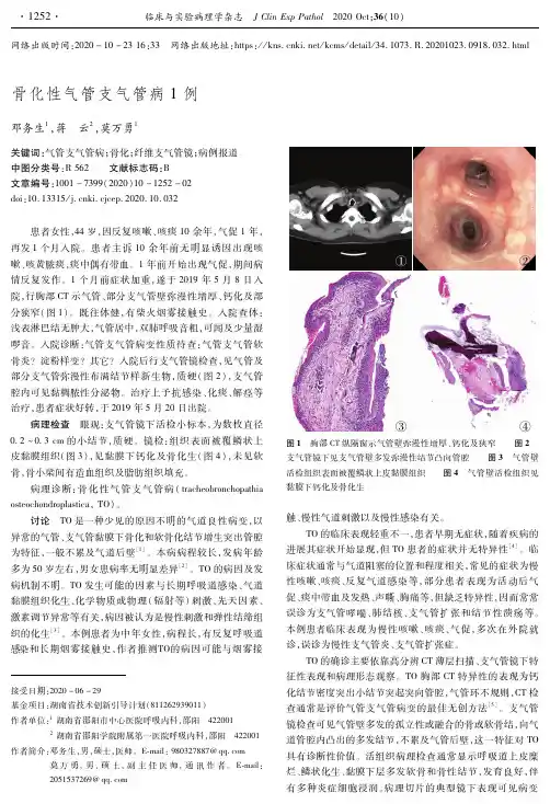 骨化性气管支气管病1例