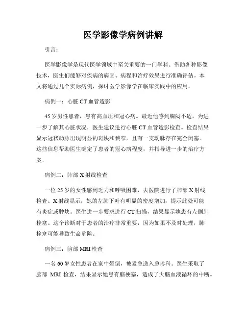 医学影像学病例讲解