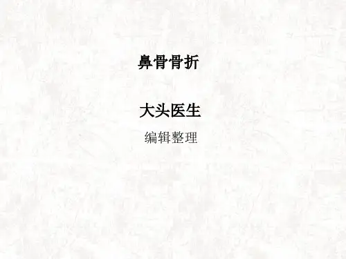 鼻骨骨折