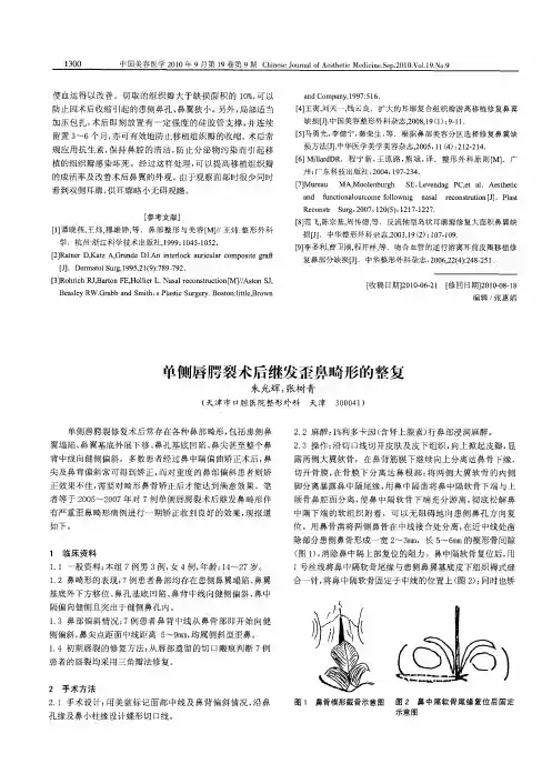 单侧唇腭裂术后继发歪鼻畸形的整复