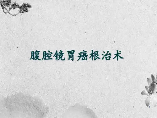 腹腔镜胃癌根治术手术配合