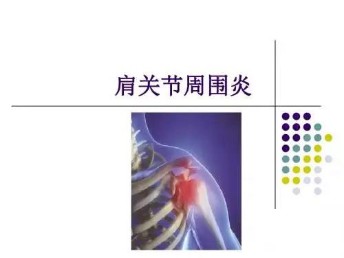 肩周炎推拿学PPT课件