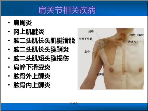 肩关节相关疾病精品课件