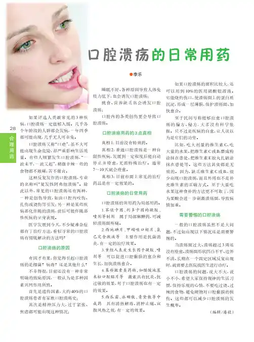 口腔溃疡的日常用药