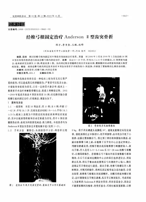 经椎弓根固定治疗Anderson Ⅲ型齿突骨折