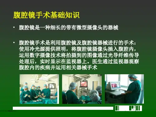 腔镜腹股沟疝修补及3DMAX简介课件