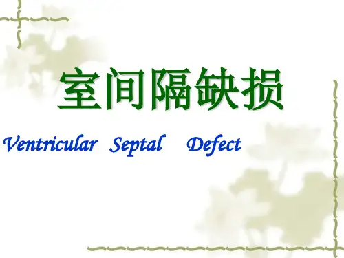 室间隔缺损PPT课件