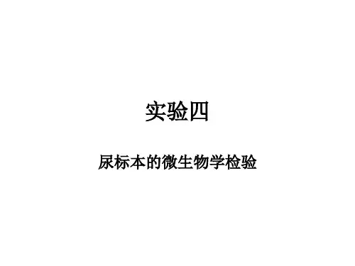 实验四-尿标本的微生物学检验
