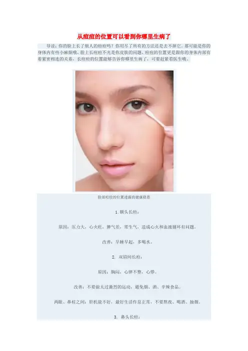 从痘痘的位置可以看到你哪里生病了(组图)