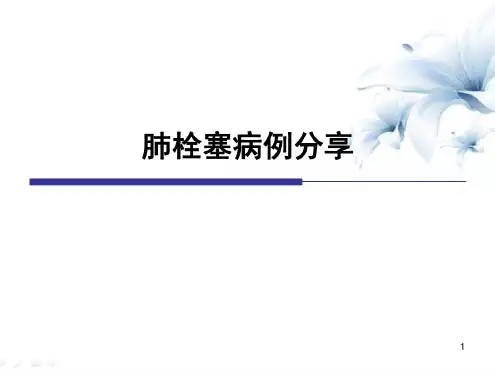 肺栓塞病例讨论