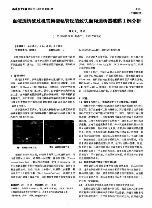 血液透析滤过机置换液泵管反装致失血和透析器破膜1例分析