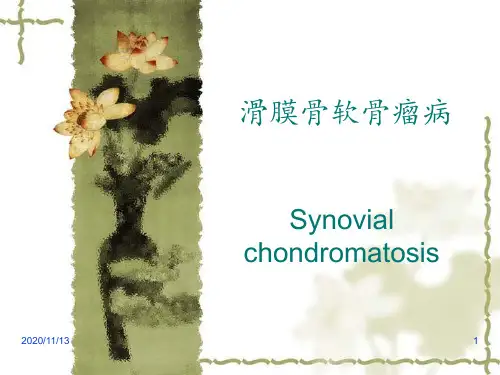 滑膜骨软骨瘤病 ppt课件