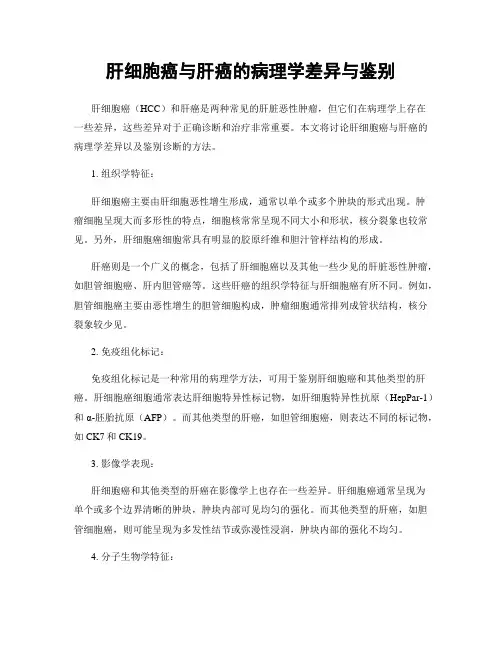 肝细胞癌与肝癌的病理学差异与鉴别