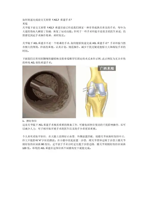 前交叉韧带(ACL)重建手术