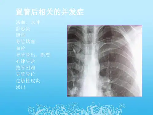 PICC置管后常见并发症和处理